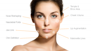 Dermal Fillers