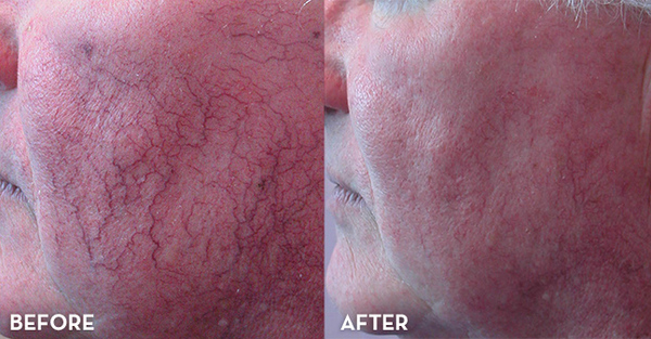 Take a look at these amazing results!! The Aesthetic Clinic