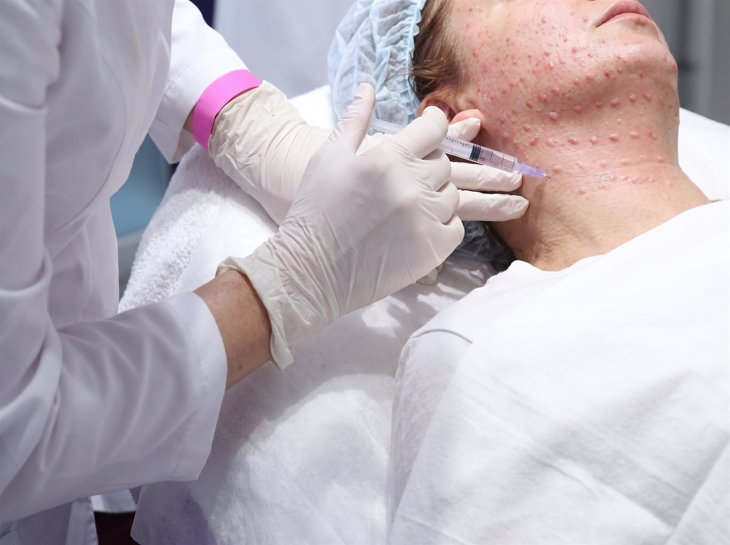 Mesotherapy treatment at The Aesthetic Clinic, Ormskirk