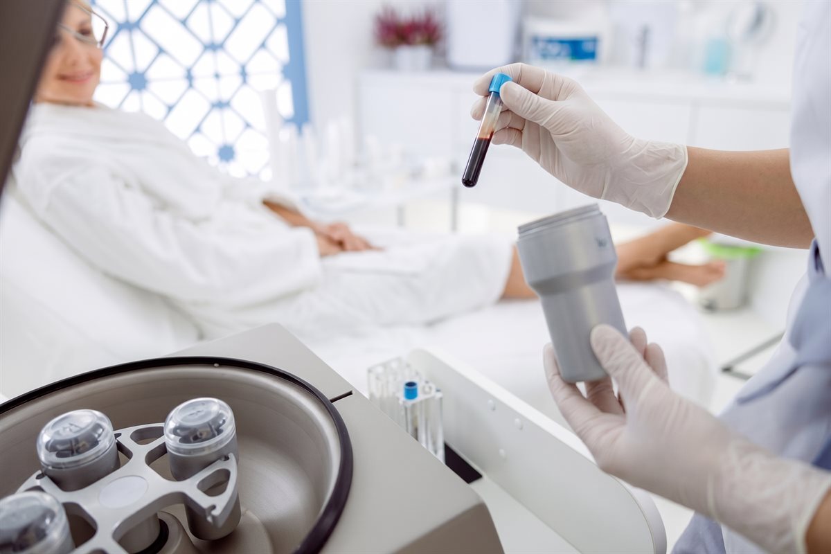 PRP Therapy treatment at The Aesthetic Clinic, Ormskirk